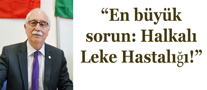 “En büyük sorun: Halkalı Leke Hastalığı!”